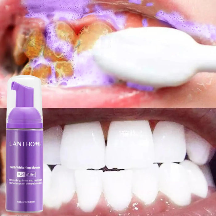 Dentifrice mousse V34 pour un traitement de blanchiment efficace et un nettoyage en profondeur des dents