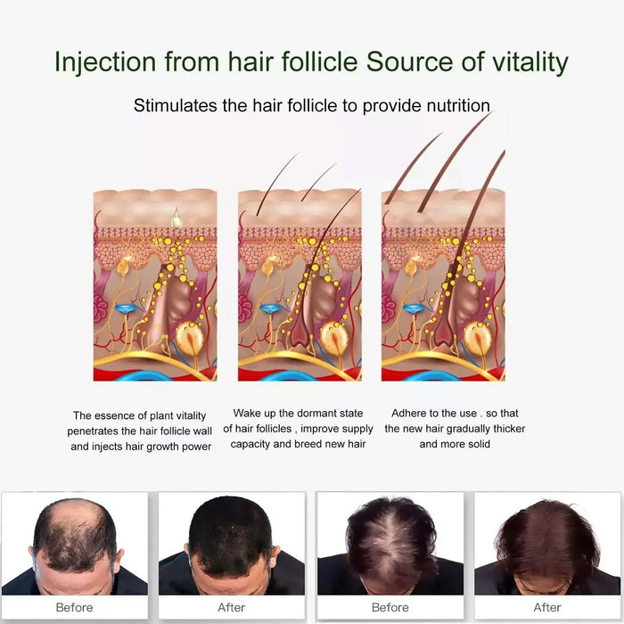 Crecimiento del cabello Tratamiento esencial para el crecimiento del cabello Fortalece el cabello Nutre la cabeza Ligero No graso Mejora la circulación sanguínea en la cabeza