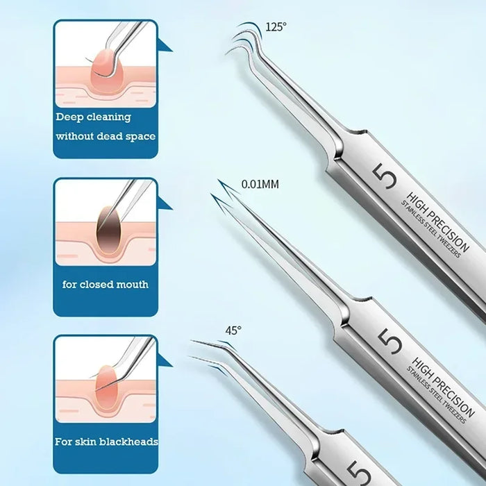 Ultrafin allemand No. Pince à boutons à 5 cellules et pince à épiler pour les soins du visage – Outil spécial pour enlever les points noirs et les aiguilles d'acné.