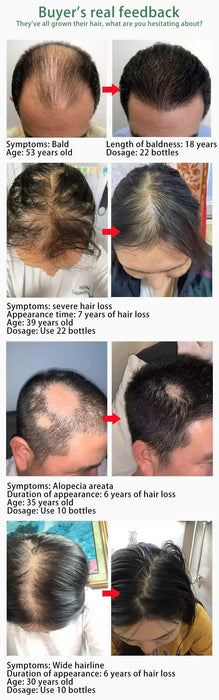 Crecimiento del cabello Tratamiento esencial para el crecimiento del cabello Fortalece el cabello Nutre la cabeza Ligero No graso Mejora la circulación sanguínea en la cabeza