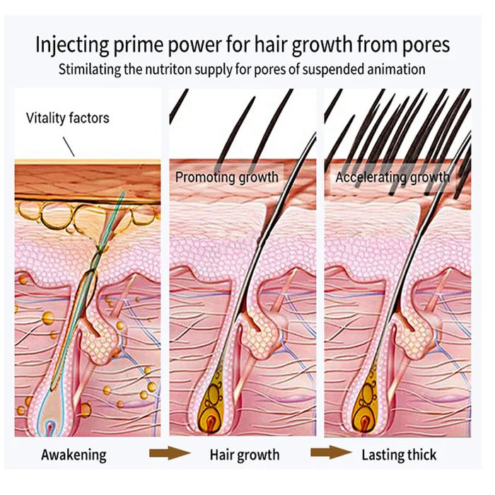 Spray de croissance des cheveux enrichi en biotine pour la force et la nutrition du cuir chevelu - Traitement contre la chute des cheveux pour hommes et femmes