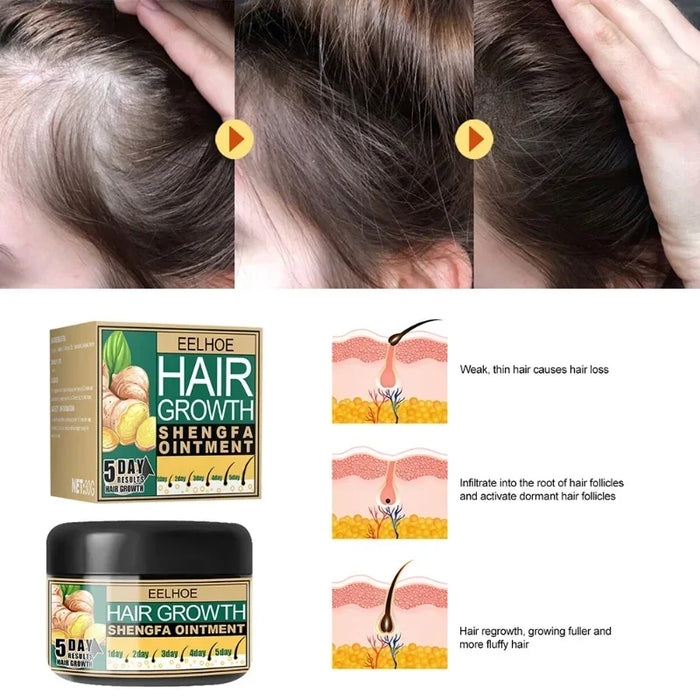 Crema para el crecimiento del cabello con jengibre - Recrecimiento, reparación y prevención de la caída y calvicie, cuidado del cabello denso y fuerte.