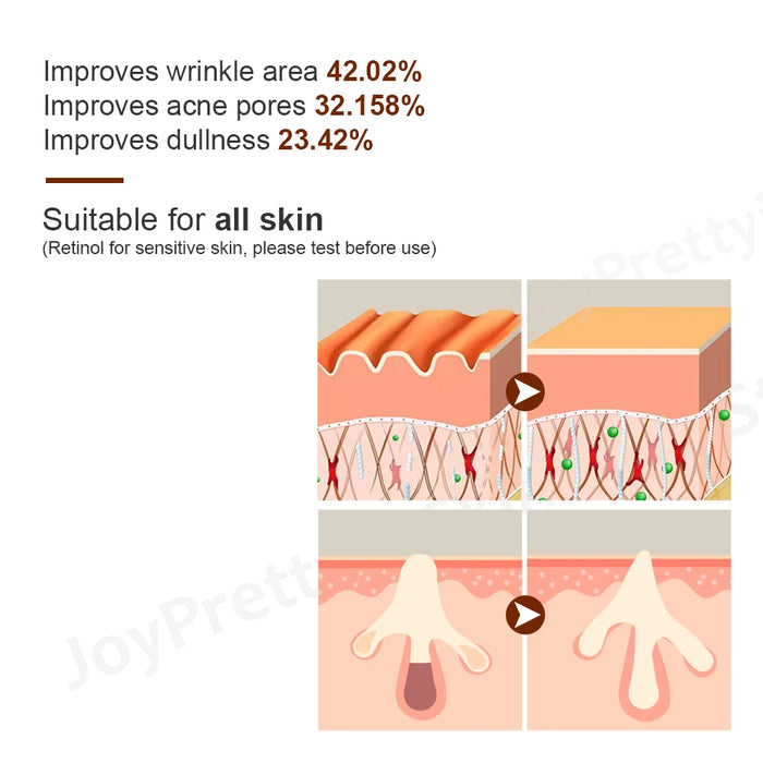 Retinol Anti-Aging-Serum mit Hyaluronsäure für das Gesicht – feuchtigkeitsspendend und straffend, JoyPretty