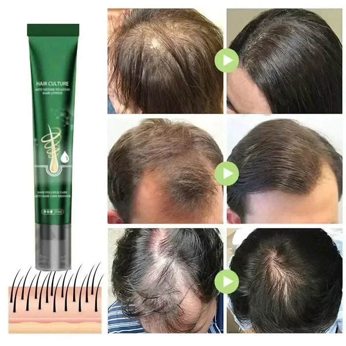 Crecimiento del cabello Tratamiento esencial para el crecimiento del cabello Fortalece el cabello Nutre la cabeza Ligero No graso Mejora la circulación sanguínea en la cabeza