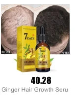 Spray de croissance des cheveux enrichi en biotine pour la force et la nutrition du cuir chevelu - Traitement contre la chute des cheveux pour hommes et femmes