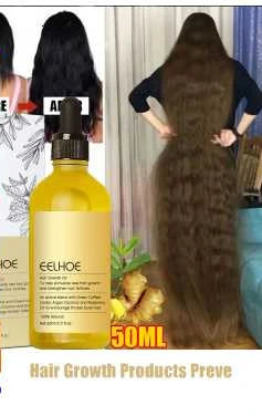 Sérum de croissance des cheveux aux huiles essentielles pour hommes et femmes-traitement nourrissant du cuir chevelu pour prévenir la chute des cheveux et favoriser une croissance rapide