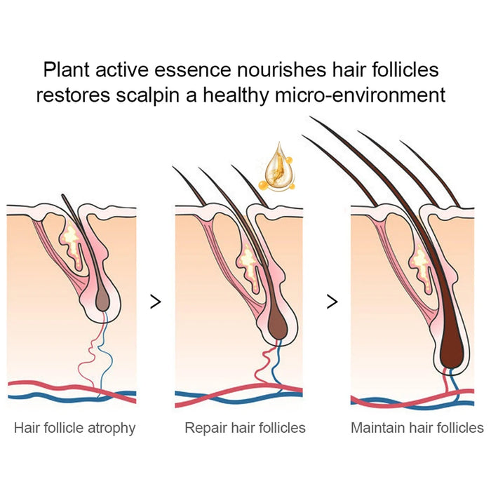 Esencia reparadora del cuero cabelludo para cabello más grueso - Suero restaurador de pérdida de cabello con aceites esenciales