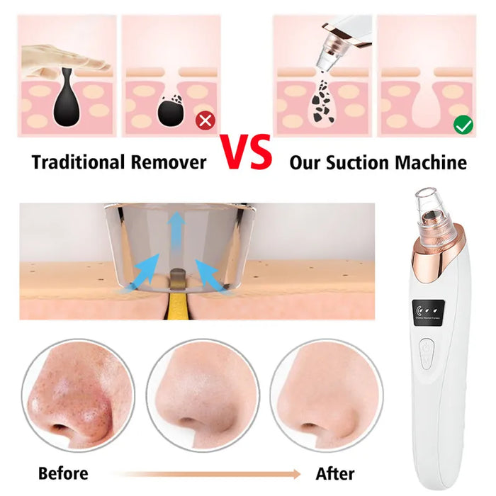 Vacuum Suction Blackhead Remover USB Rechargeable Facial Pore Cleaner Acne Pimple Comedone Extractor Care Tool