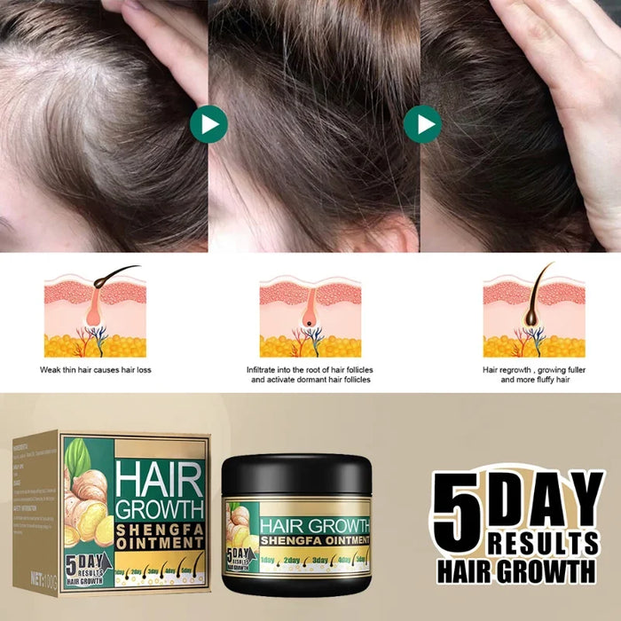 Crema para el crecimiento del cabello con jengibre - Recrecimiento, reparación y prevención de la caída y calvicie, cuidado del cabello denso y fuerte.